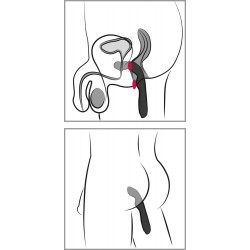 Rebel P-Spot - Analvibrator